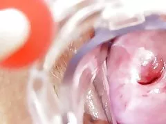 Umazani medicinska sestra dobi solo